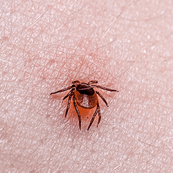 Tick embedded in skin